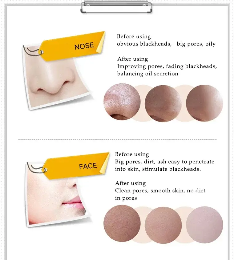 BIOAQUA Activated Carbon Blackhead Removal Peel-Off Mask — 5